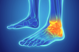 Lansdale PA chiropractor helps ankle injuries